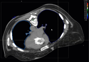 Animation: treatment plan sacral chroma