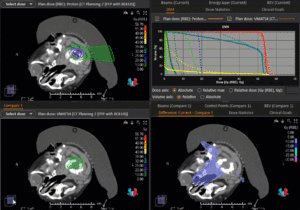 Animation: Treatment Plan Comparison Ependymoma